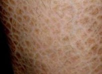 ���۲�������