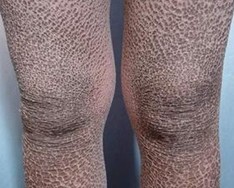 ���۲�Ϊʲô��������