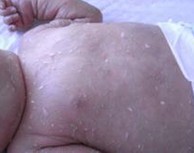 ���������۲����ٴ�֢״