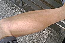 �������۲�������α���