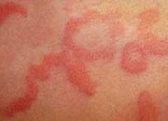 ������ݡ�����֢״