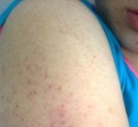 ��γɵ�ԭ������Щ