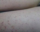 �̵��ഺ��֢״����Щ��