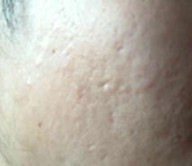 �ഺ���������Σ��