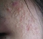 ���������ž��