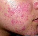 ����ߵĽ�����ʳ