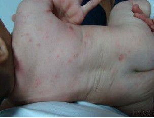 Ӥ�����괯