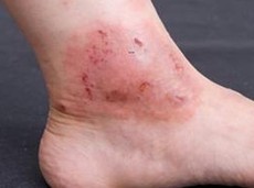 ���ǻ�ʪ���ԭ��