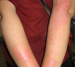 Ƥ��ʪ�����������Щ