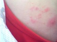 ʪ����Ĵ����֢״