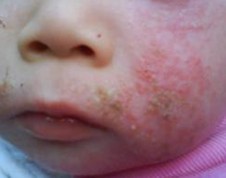 ʪ�������������Ч