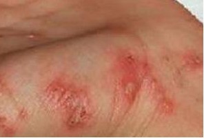 �괯��Σ��