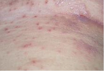 ��ô���ý괯Ԥ��