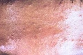 �괯�봫Ⱦ֮��Ĺ�ϵ