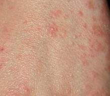 �괯������