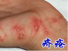 �괯���Ҫ��ô����