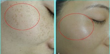 ȸ�߸�����������