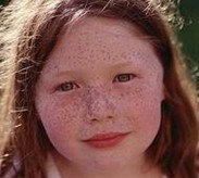 可爱的雀斑使怎么来的