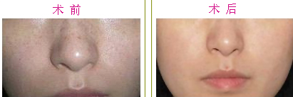 ȥȸ�ߣ�ȸ����ȥ����