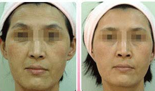 �ٴ���֤����Щʳ�����ȸ����ʵЧ