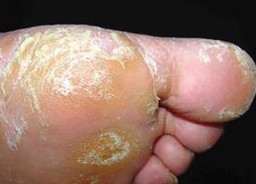 ��Ѣ���ߴ��ڵĴ����뷨�͹۵�