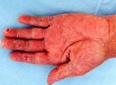 ��������Ƥһ������Ѣ��