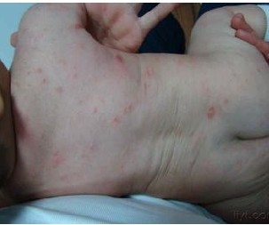 Ӥ�׶��괯�����˵��