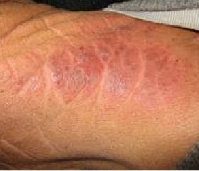 �괯������Щ����֢״