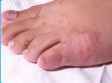 ����Ѣ�Ļ�����Ԥ������