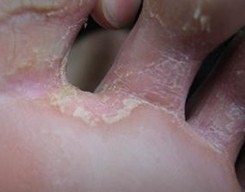 ����Ѣ��Ԥ����ʩ