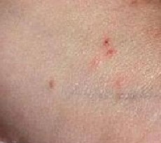 ���˽괯�ᴫȾ��������