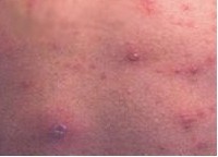 �괯��Σ��