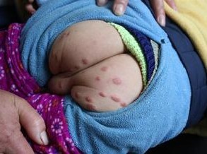 С����Ⱦ�괯��ô��