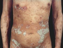 ţƤѢ��ֹ�ڵı���