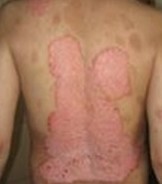 ţƤѢ����ķ���