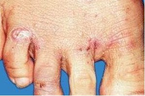 �괯��Σ���м���