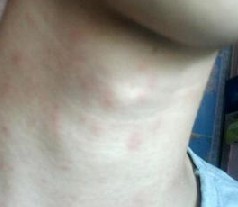 �괯�Ĵ�Ⱦ����Ⱥ��