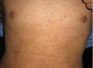 ���ý괯������ʪ��