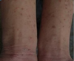 ͨ��֢״��ʶ�괯