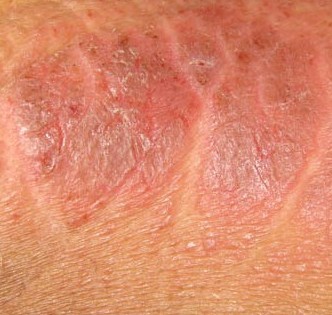 �괯����Ƿ���д�Ⱦ��