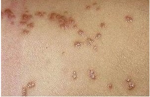 �괯��Σ��