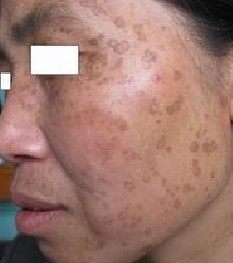 �������ƽ괯