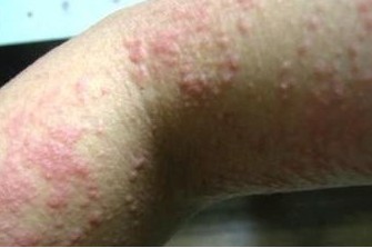 �괯������