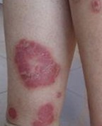 �ϲ���ҽ����ţƤѢҽԺ