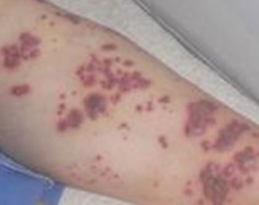 ��״�����Ƿ�Ⱦ