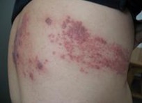 ��״���Ⱦ��