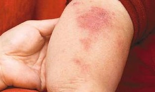 ���ƽ괯�����ҩ��