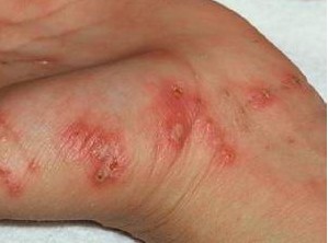 �괯������