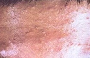 �괯����Ϊ�����׷�������