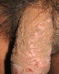 ���ҽ괯��֢״������